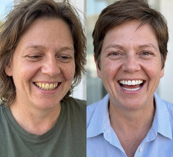 Customer smile comparison