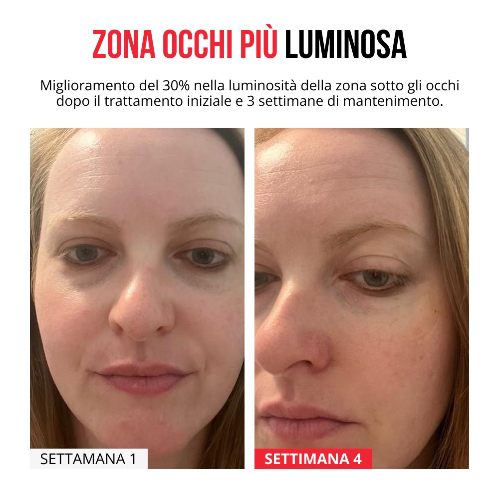 Cerotti innovativi con micro-aghi