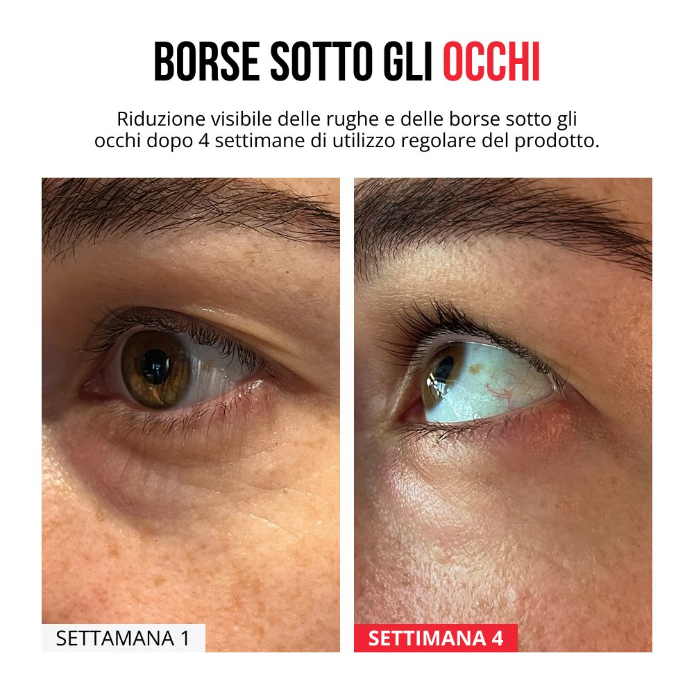 Cerotti innovativi con micro-aghi